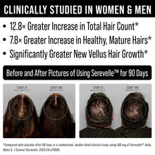 2-in-1 Clinically Studied Serevelle Saw Palmetto + Biotin Hair Growth Supplement. 12.8X Improvement in Total Hair Count in 90 Day Serevelle Study. DHT Blocker, Regrowth Pills for Men & Women